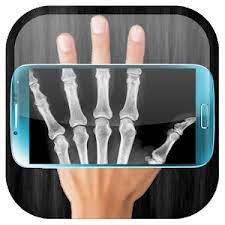 X Ray Scanner APK APK